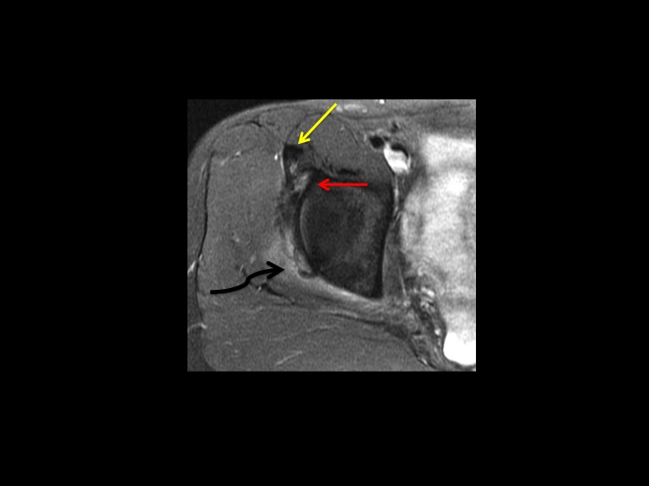 Figure 4 for case rectus femoris muscle ( RID2698 )